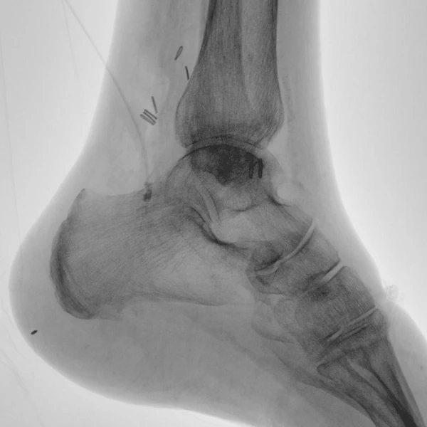 clinical image c arm x ray.jpg
