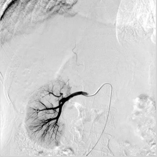 angiography system