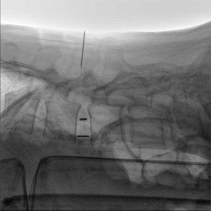 C7